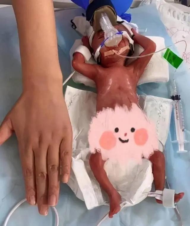 #给早产儿家长的8个建议##早到的精彩#[奶瓶]①早产宝宝体内调节温度的机制发育