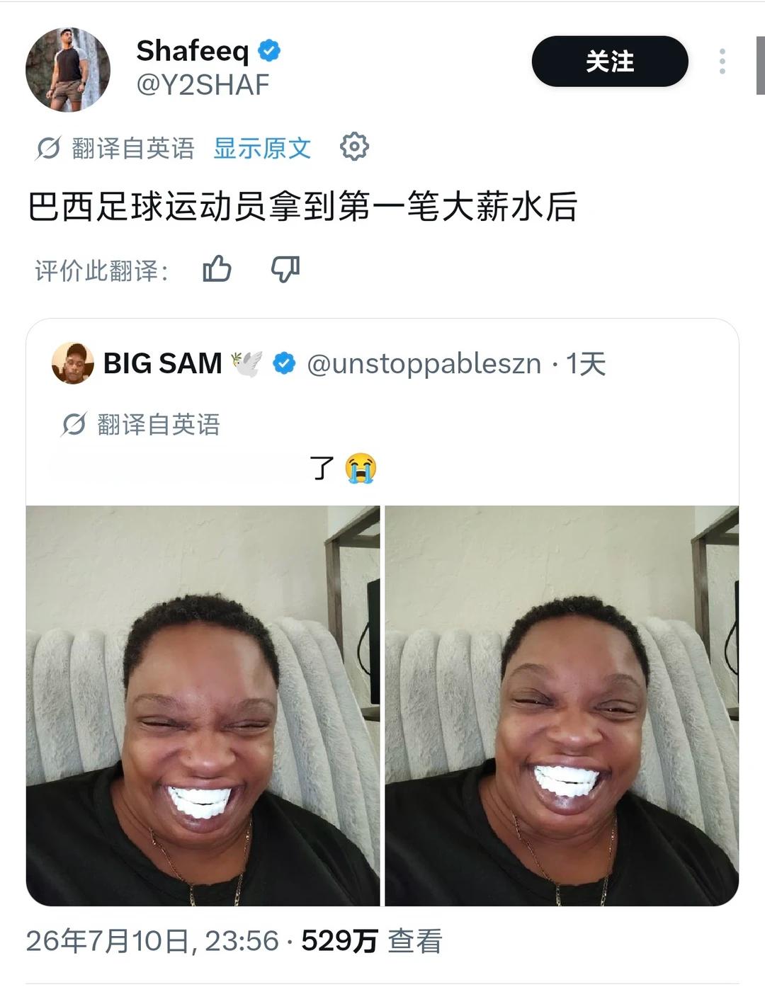 本人结束正畸后： 
