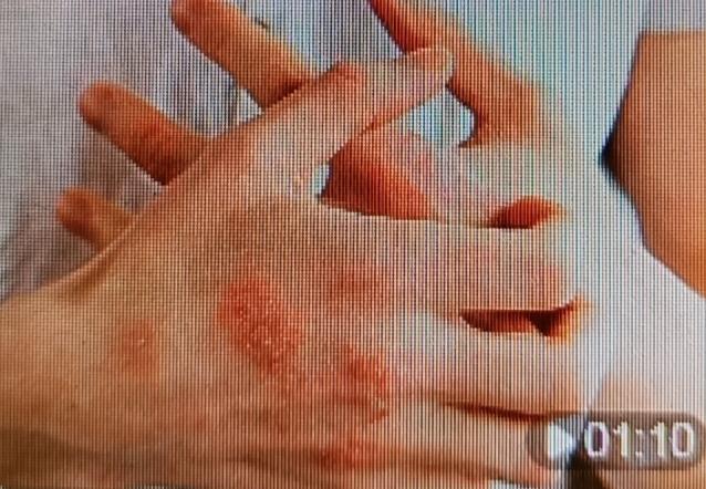 湿气这玩意儿，简直就是健康的“小妖精”，难缠得很。想赶走它，饮食上得下功夫。像薏