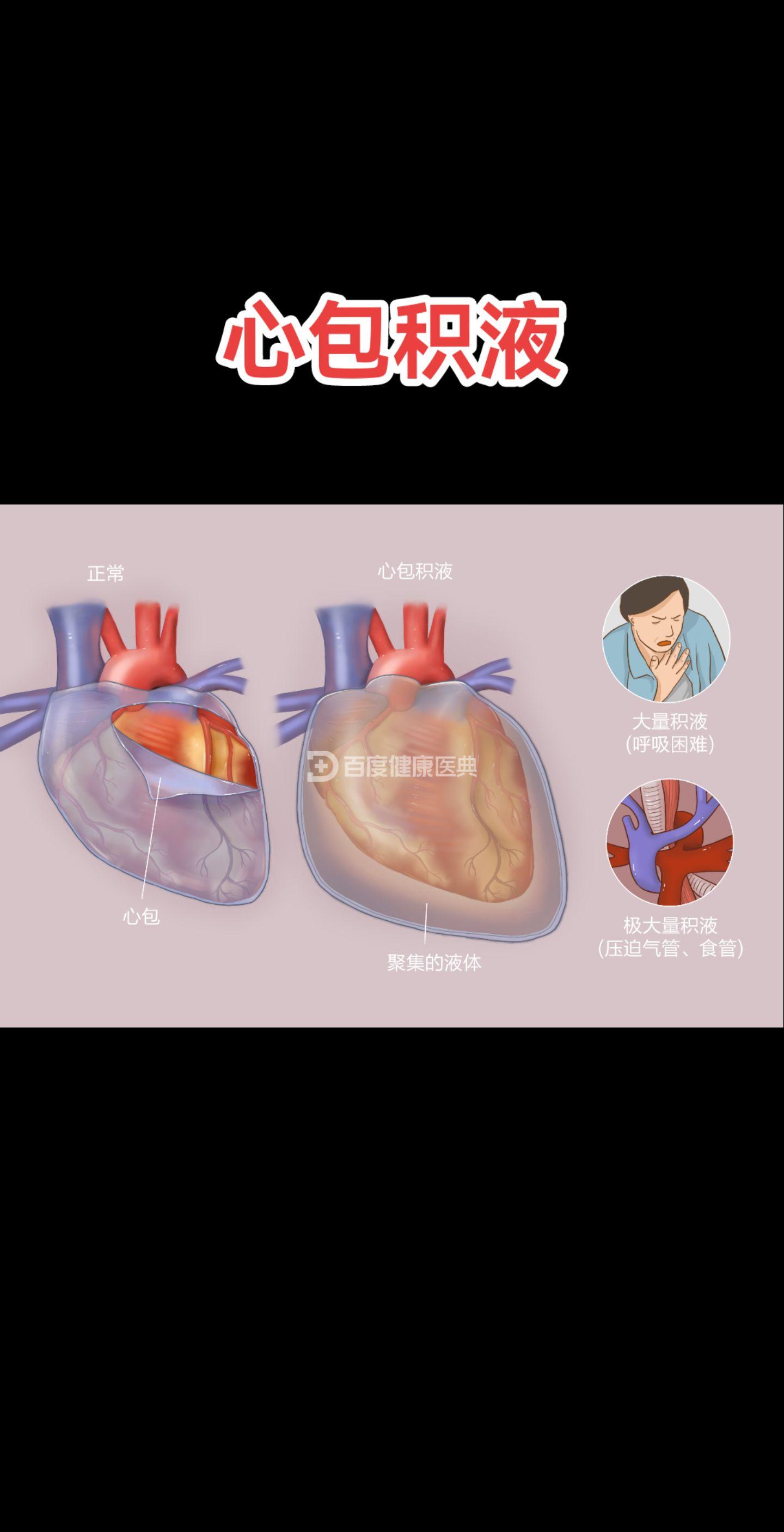 医学科普 医学影像 医路前行 科普一下