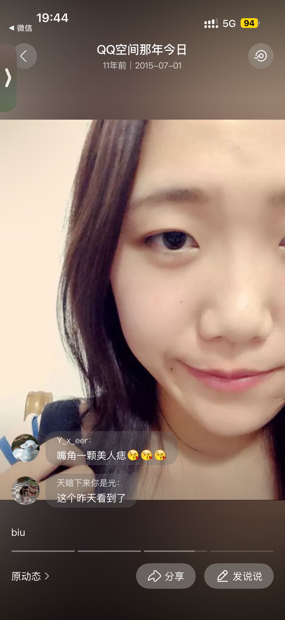 打了眉弓 鼻基底 嘴唇，双眼皮本来是小内双，大学时候用双眼皮贴贴出来了开扇，还有