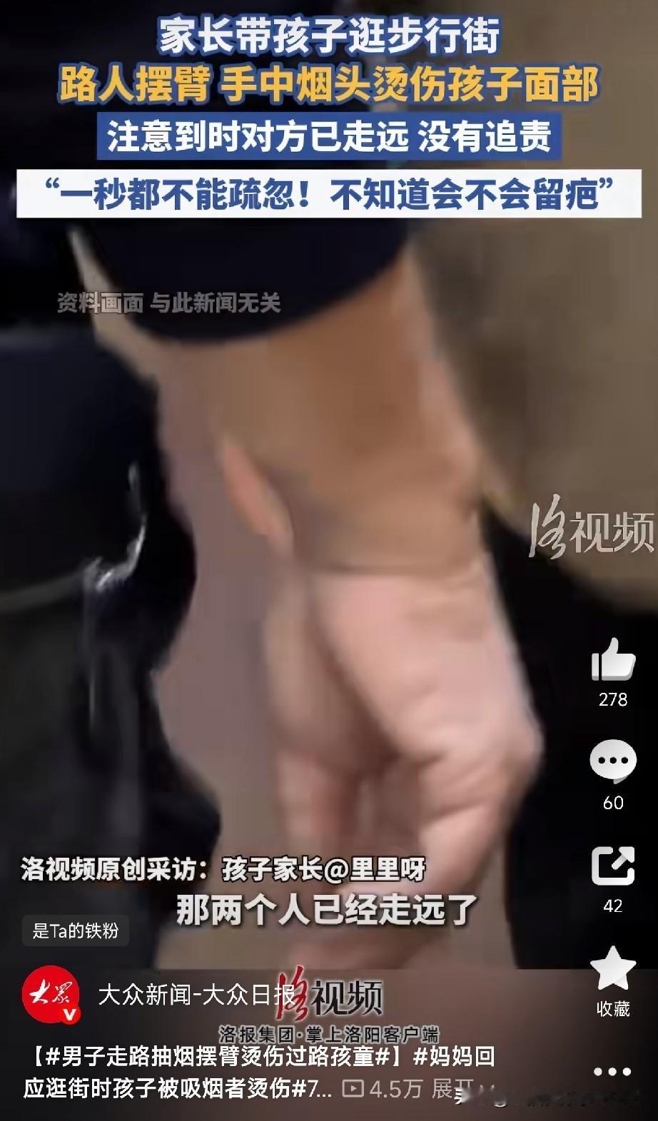 抽烟的朋友注意了，就因为您走路这个习惯，孩子脸上可能留一辈子的疤！

河南一位妈