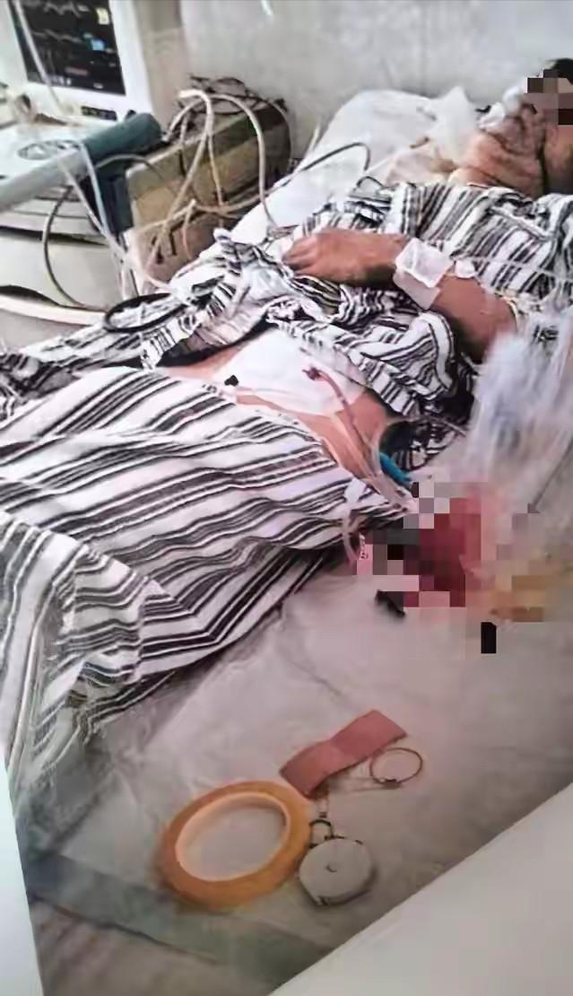 没天理了！云南禄丰，同学叫15岁男孩出去玩，男孩害怕对方打架闹事，就没有去赴约，