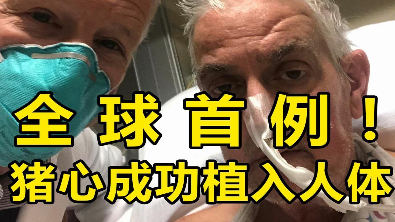 “给人移植猪肾脏？”刘顺攥着病危通知书的手在发抖，遂即下定了某种决心。

"第一