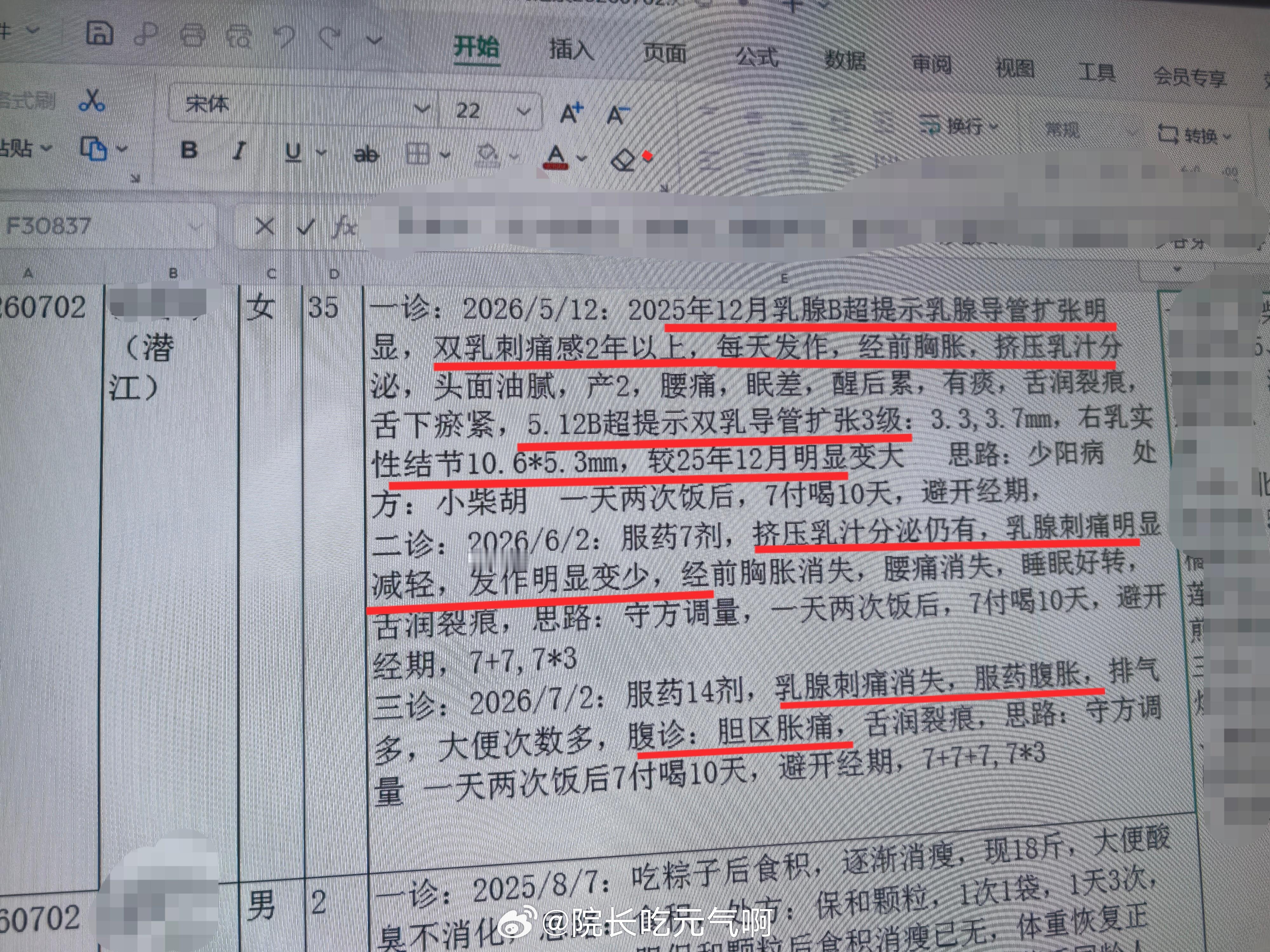 中医乳腺导管扩张   效案一例 女 35岁  双乳刺痛2年，每天多次发作，挤压分