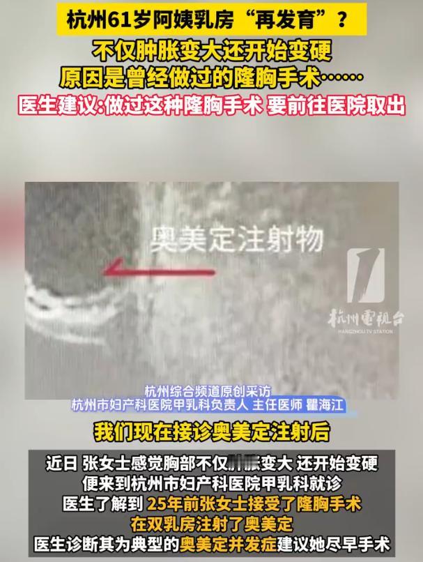 差点解释不清了！浙江杭州，61岁女子洗澡时，突然发现自己的胸部似乎变大了，但这个