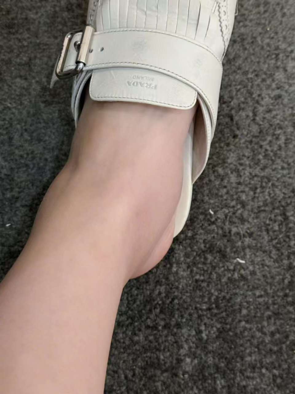 张馨予雨林徒步后我的脚肿成了猪蹄 张馨予雨林徒步后还是高估自己了 张馨予雨林徒步