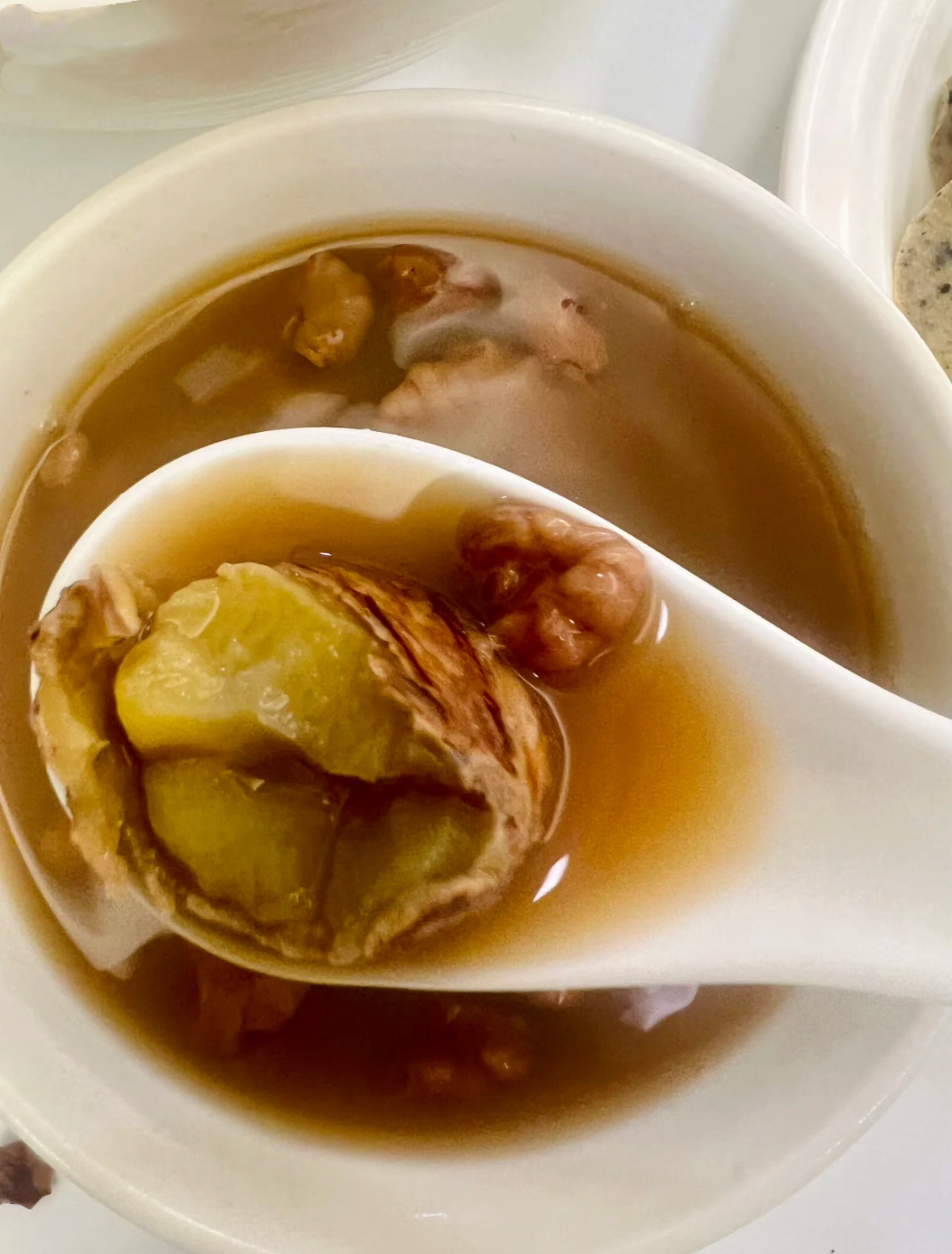 今年小雪特别需要注意的健康问题是：腰痛、尿频，要防止腰受寒。因为今年“冷暖起伏显