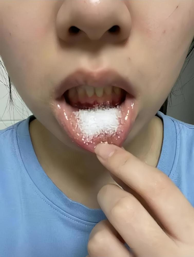 疼死我了口腔溃疡好几天了，一直不好，尝试了很多办法都不行，我婆婆说撒盐好的快，然