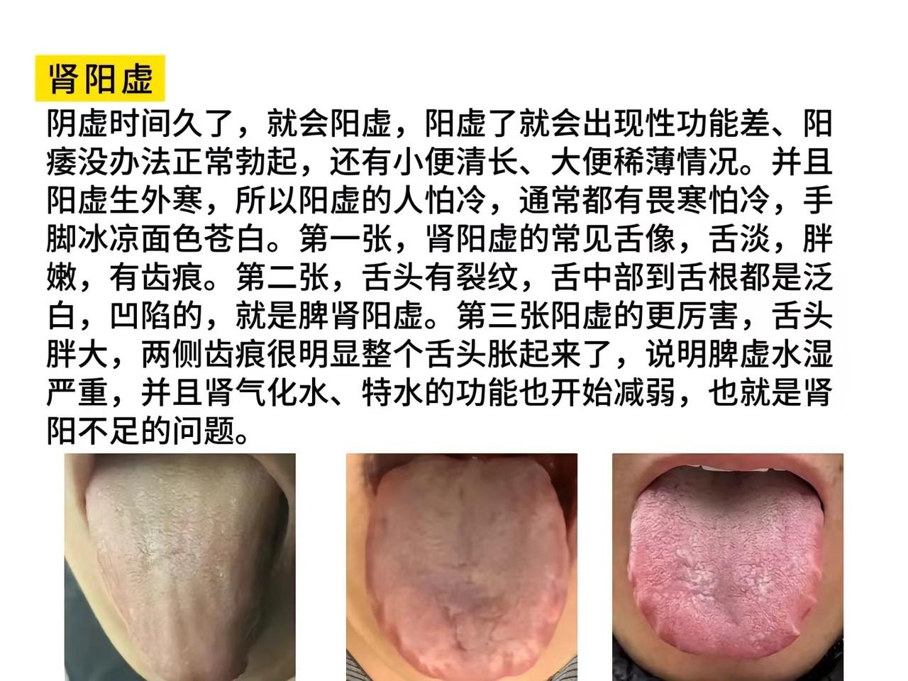 肾阳虚、肾阴虚、肾气虚、肾精不足有什么区别？[中国赞][中国赞][中国赞]
今天