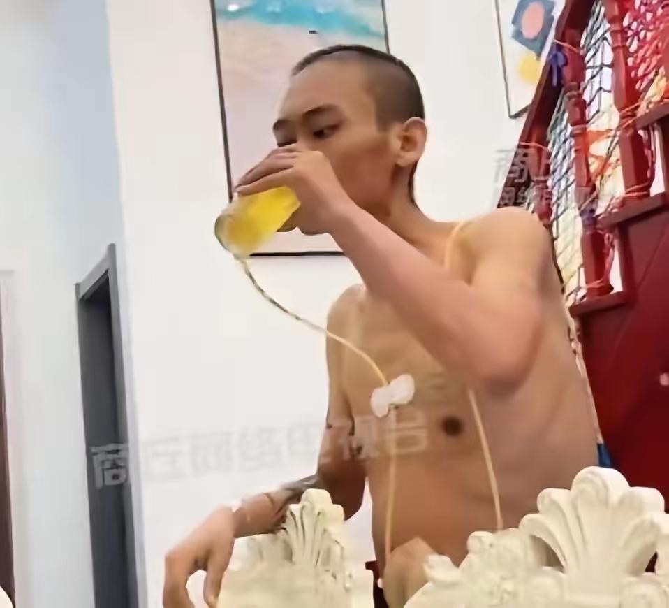 他毅然拔掉管子，用仅有的积蓄买了157罐啤酒。主治医生无奈摇头，喃喃道：“没见过