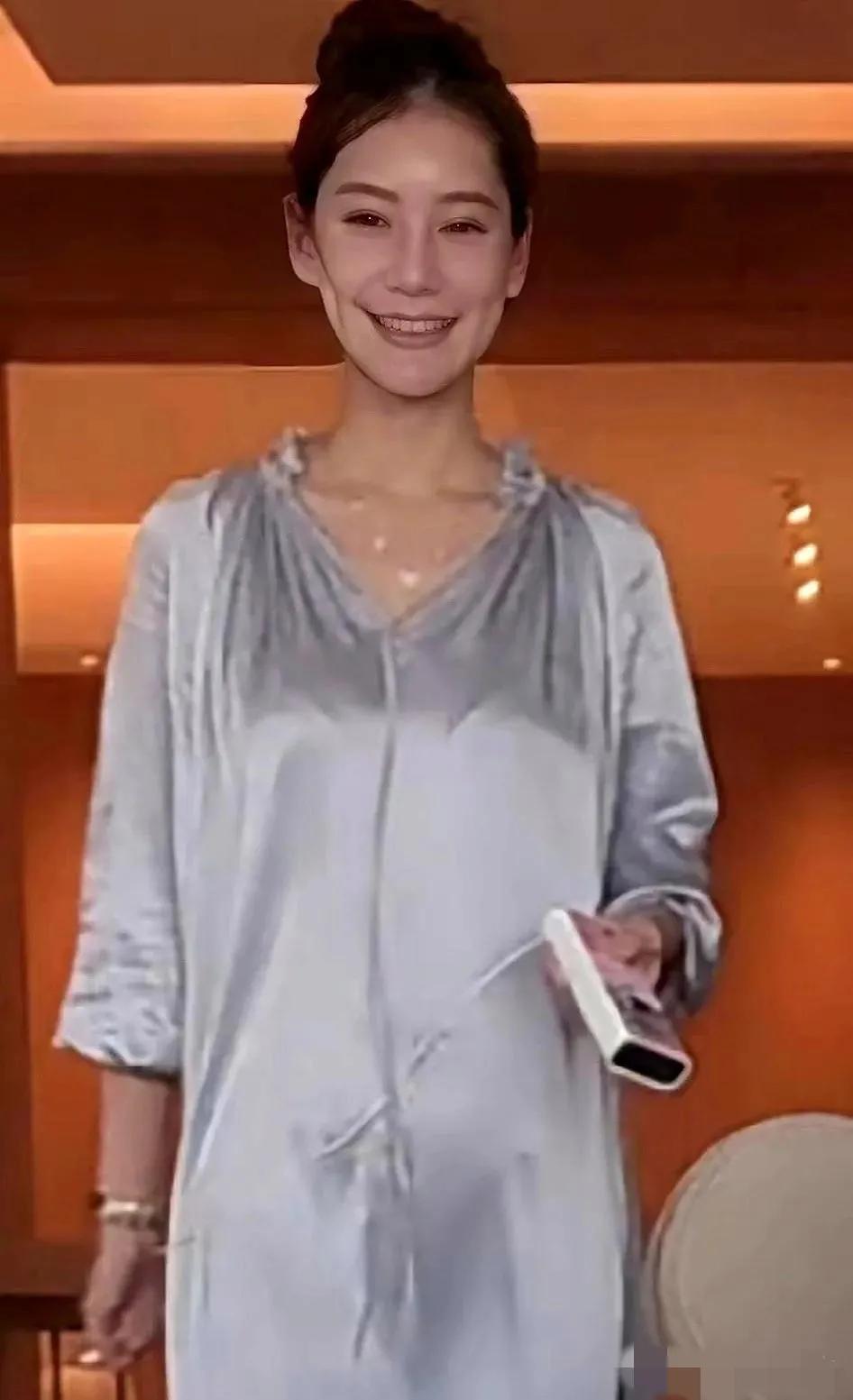 天呐，马筱梅的脸太吓人了，其直播时笑起来感觉怪怪的，两侧脸颊不对称，右侧凹陷严重