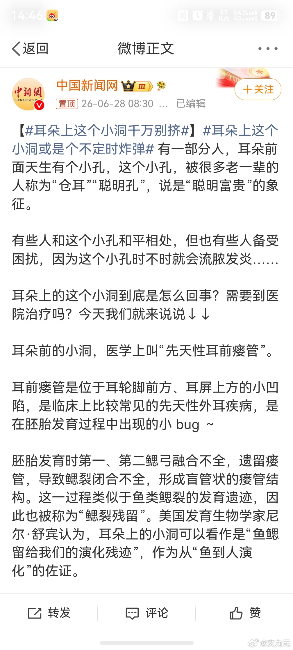 耳朵上这个小洞千万别挤，你不说，我还不知道这个耳洞，你一说我反而还忍不住