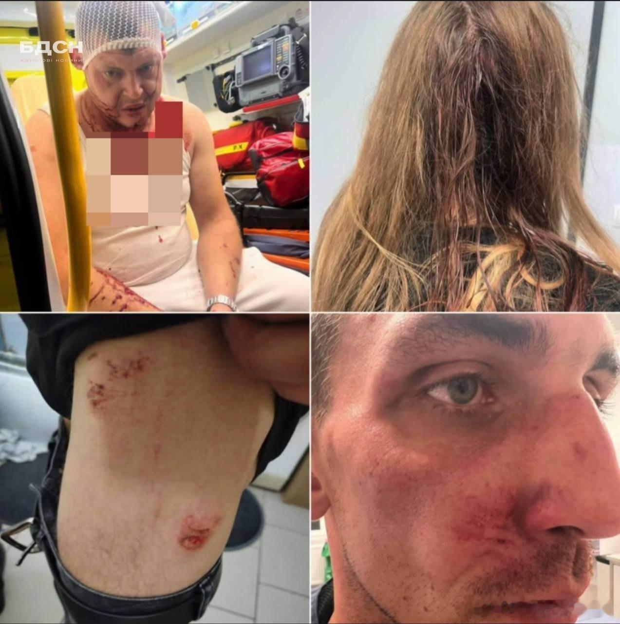 在波兰的旅馆，三名乌克兰人又遭到残酷的殴打。两名乌克兰的男子和一名女子都被割伤，