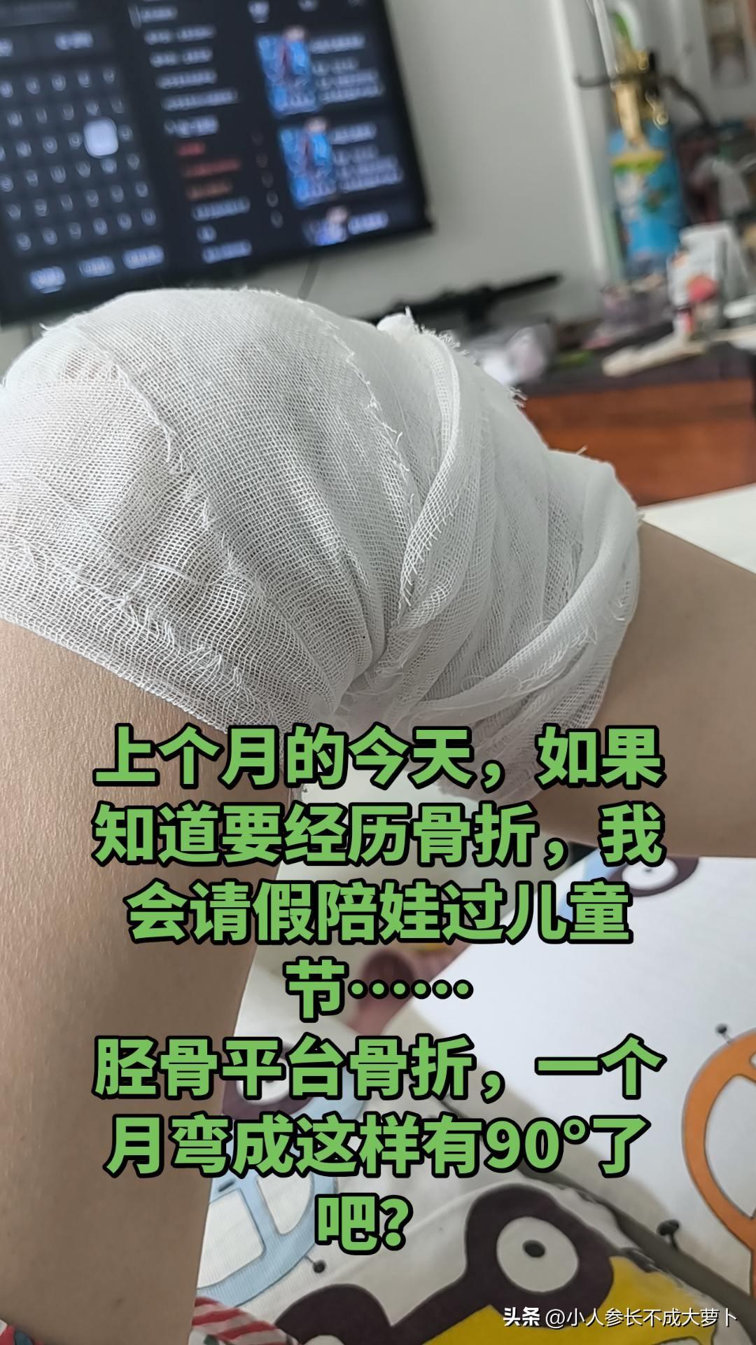 骨折后，一个人在家照顾自己，还要照顾孩子，这大概就是没人帮衬的心酸吧！
目前还没