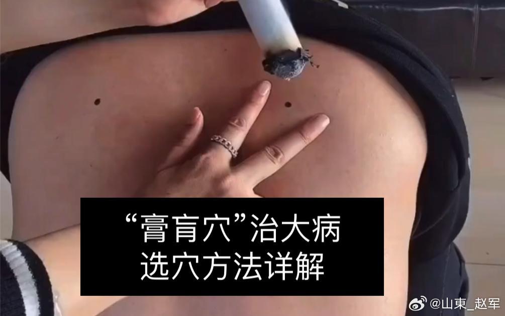 《黄帝虾蟇经》三十日月相人气聚处（禁灸部位）总法则：人气所聚之处，忌艾灸、针刺，