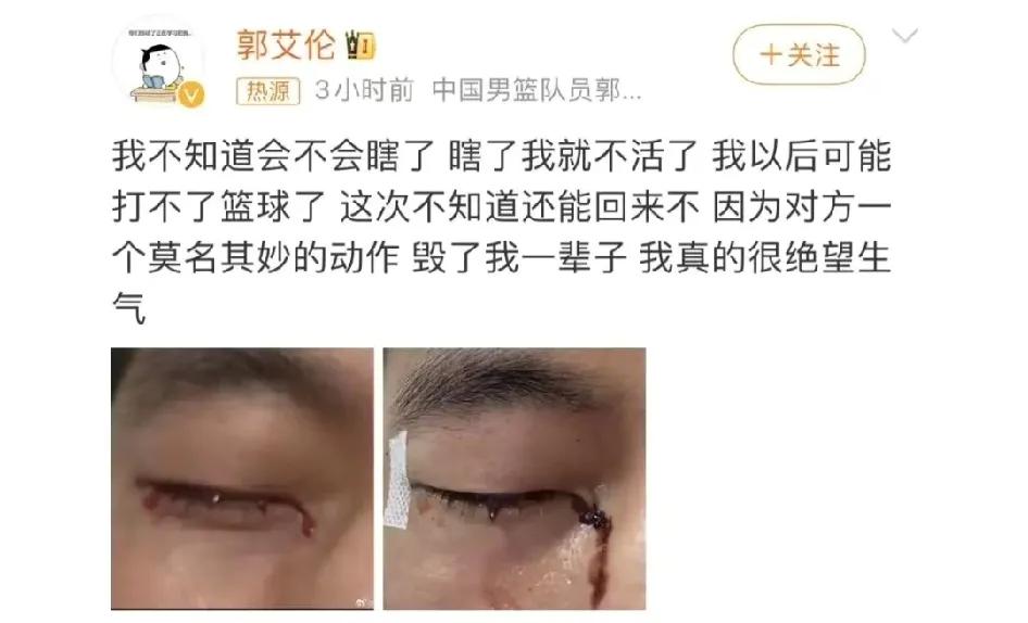 大侄子郭艾伦发文“毁了我一辈子”，莫名其妙的一个动作，发生这样的事情究竟当时是什