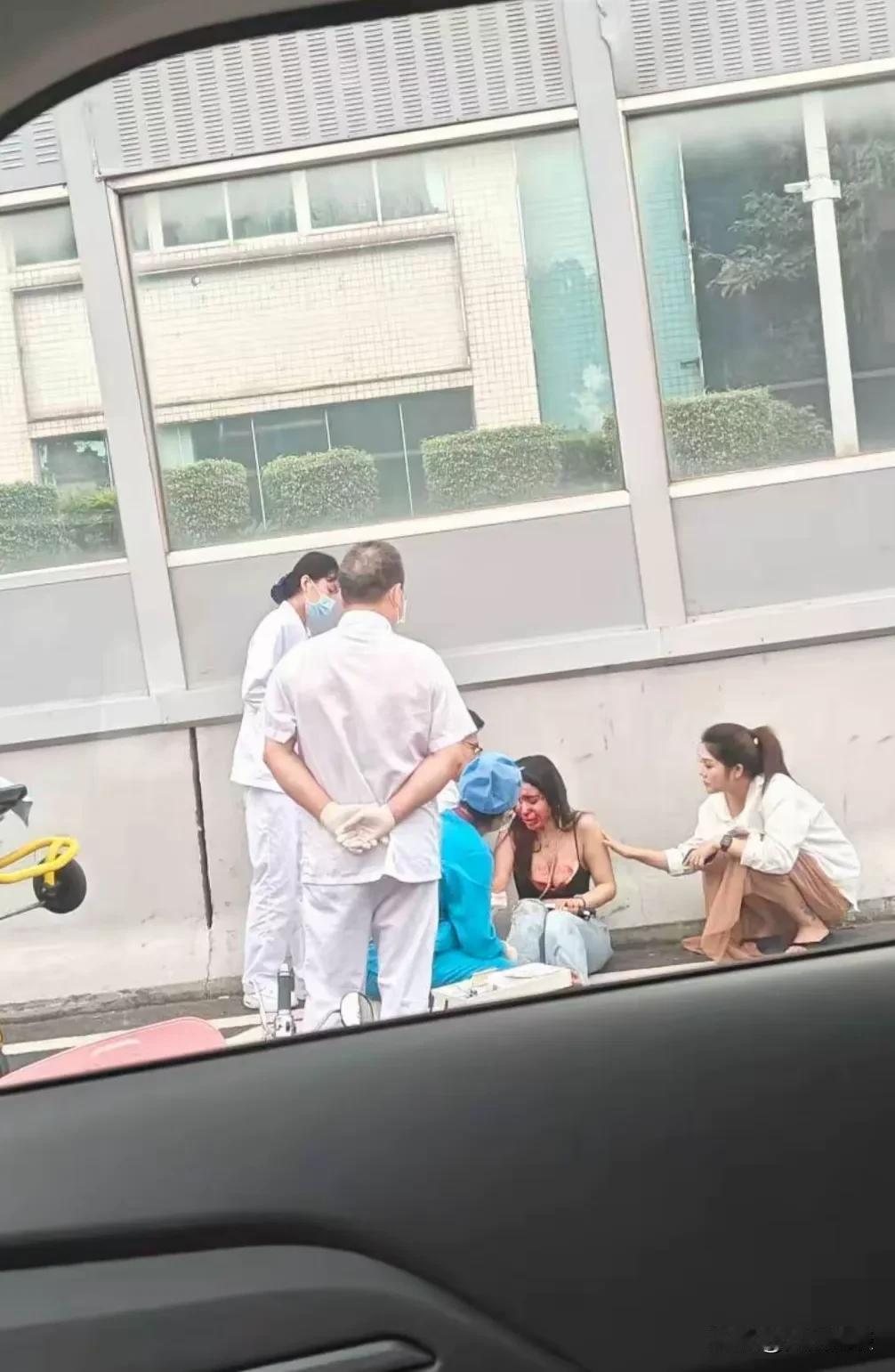 又是开电鸡上内环飙车，美女受伤不轻啊，头破血流！
一看就是大概率不戴头盔！

广