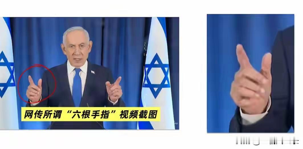 内塔尼亚胡亲自发视频证明自己不是“六指琴魔”
以色列总理内塔尼亚胡到底是不是“六