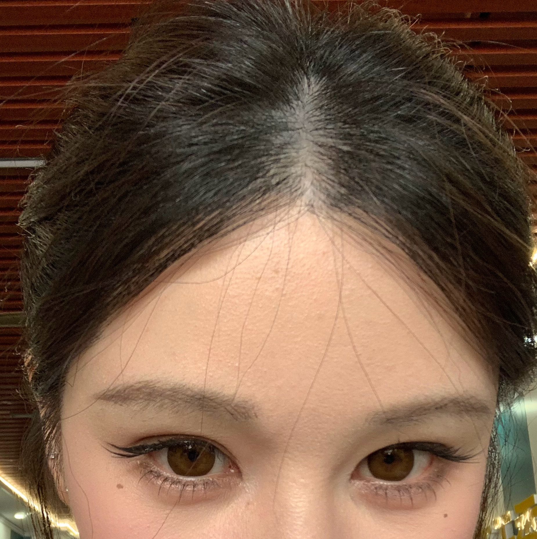 打卧蚕第6年了，作为一个补针频率挺低的一个部位，这几年每次补针都能感觉到技术在进