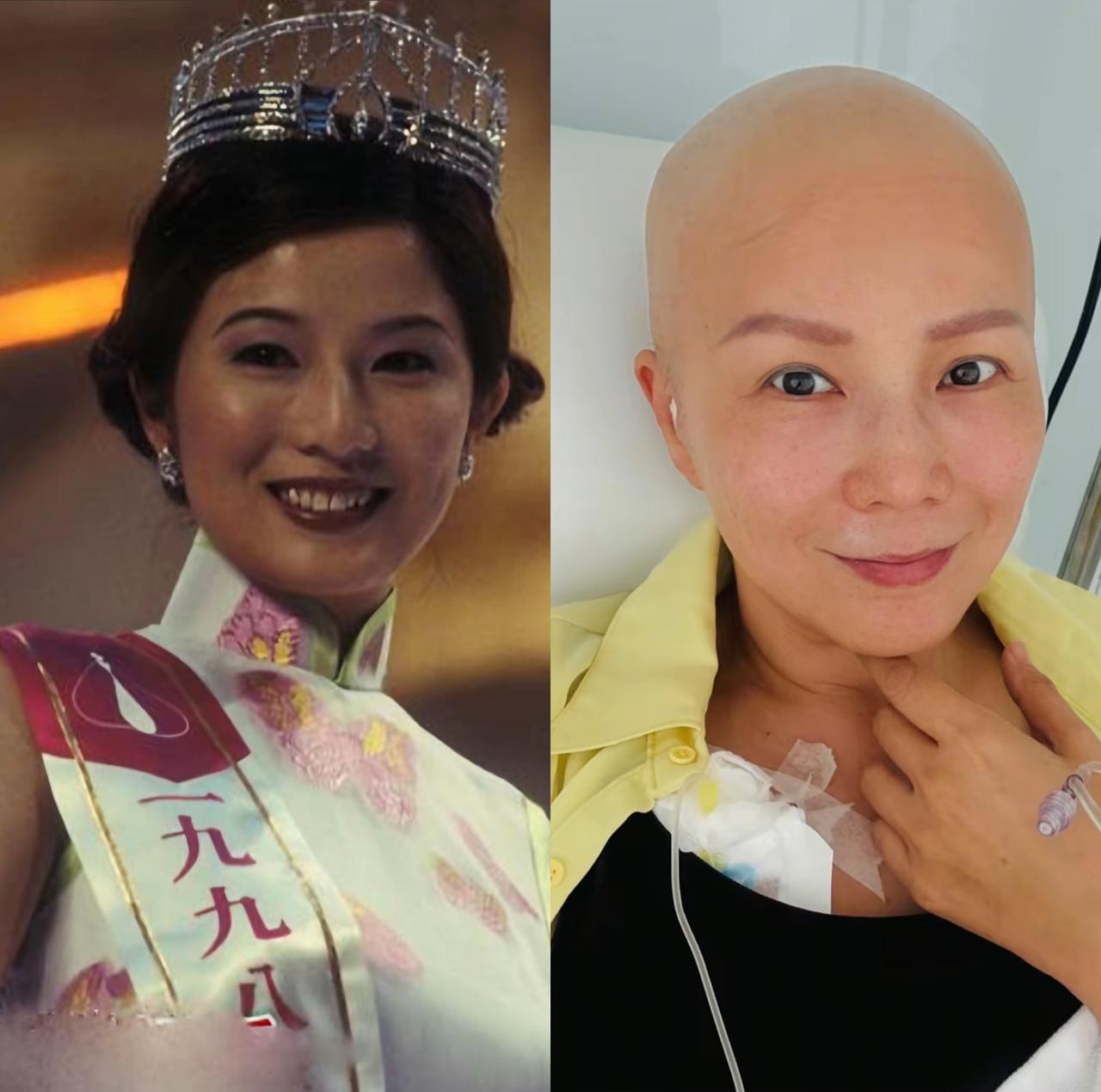 98年的港姐季军吴文忻，癌症晚期，老公得知后跑了。

2022年，她按摩时被按出