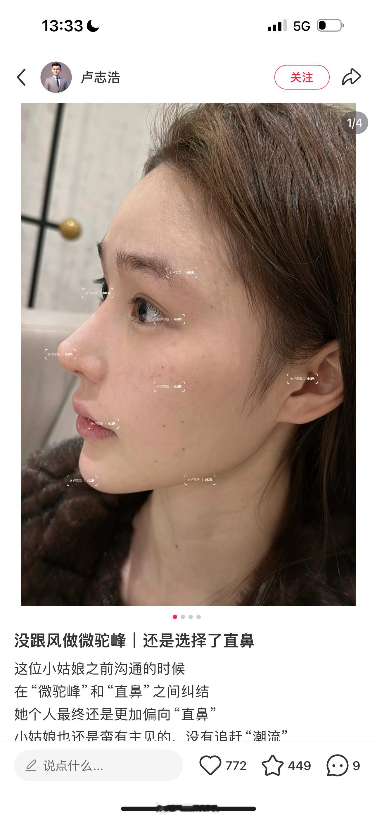 bb们有啥子适合我的鼻子模版吗[求关注]看了很多都没有特别喜欢的[泪]不白p哈 