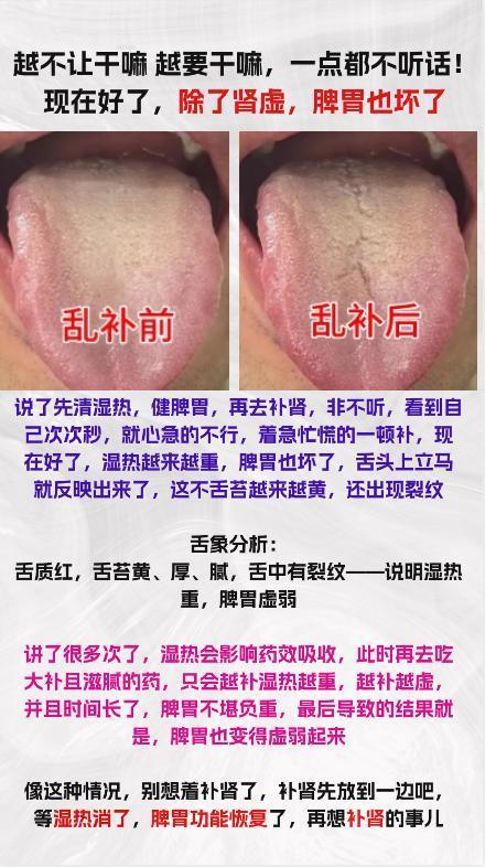 有的患者，越不让他干啥，他越干啥，现在不止肾虚，脾胃也不好

#养生##中医#