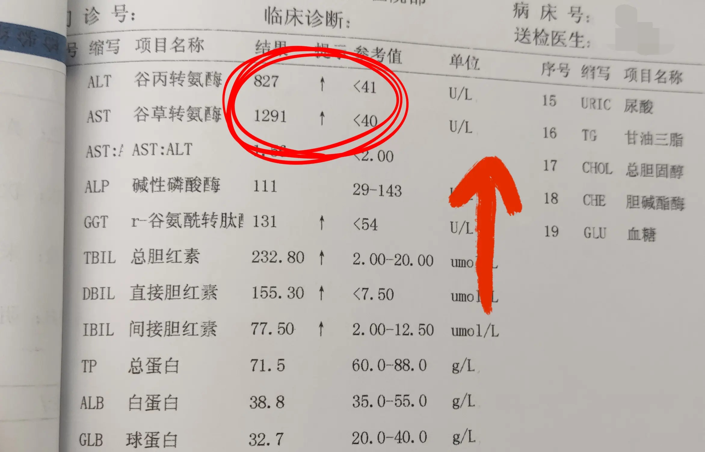 肝功能中这项指标的升高可能不用管！。今天主要说的就是转氨酶这个指标，其...