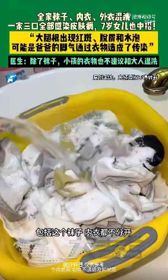 【衣服混洗致一家三口感染皮肤病，真相令人震惊！】

当我们习惯了“省时省力”的洗