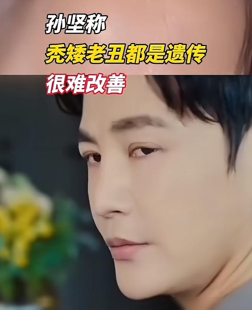 别挣扎了，你的秃矮老丑，孙坚说都是命。
 
“秃矮老丑都是遗传，很难改善。” 这