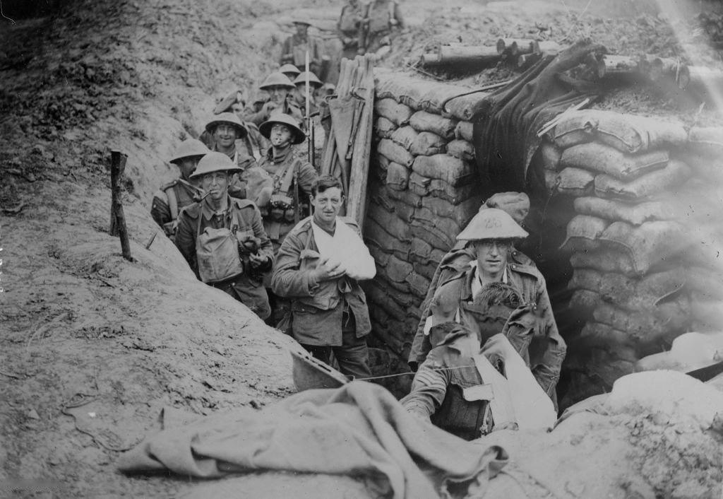 "受伤了，他反而笑了——1918年这张战壕照，藏着一个让人心酸的秘密"
你先别急