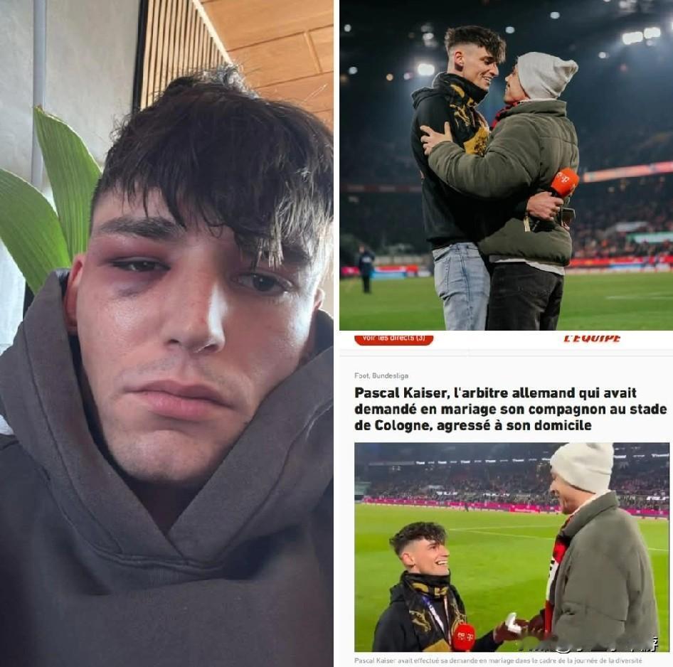德国足球裁判帕斯卡尔·凯泽在球场上公开向男友求婚一周后，竟在自家遭遇三名男子的暴