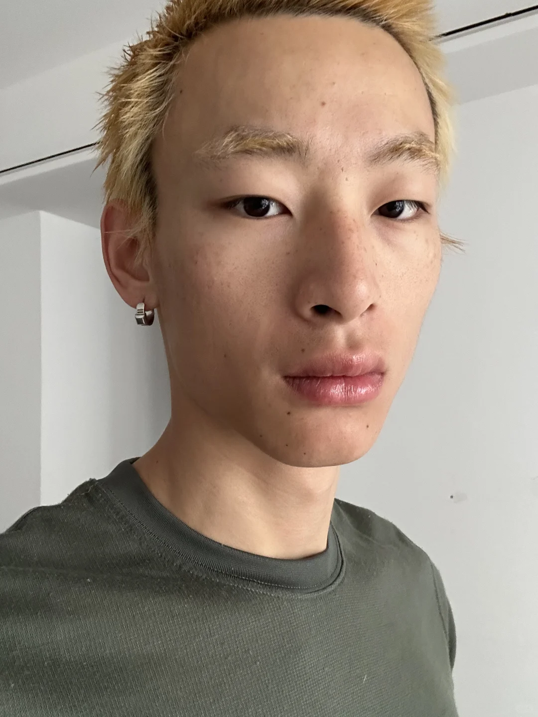 免费的丰唇手术和晒伤妆😵‍💫