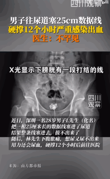 这都是什么癖好呀！广东深圳，一男子深夜里竟然将一根长达25厘米的数据线，一点一点