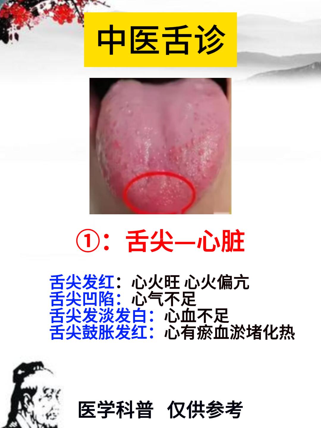 中医舌诊，基础知识分享：

1：舌尖—心脏    2：舌前端——肺脏    3：