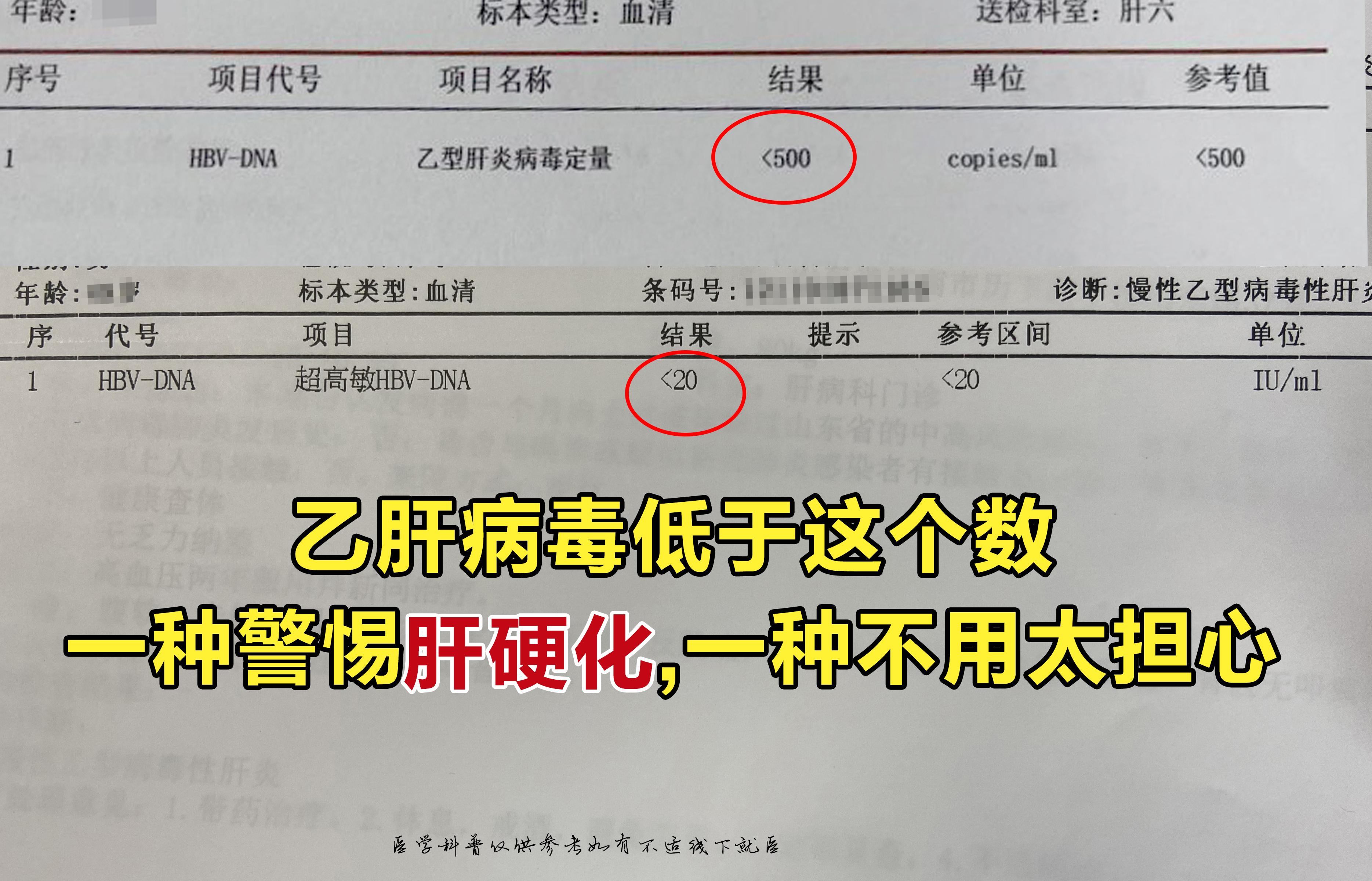 38岁的张先生让我惋惜，乙肝吃了恩替卡韦7年，却发展到肝硬化，详细的看...