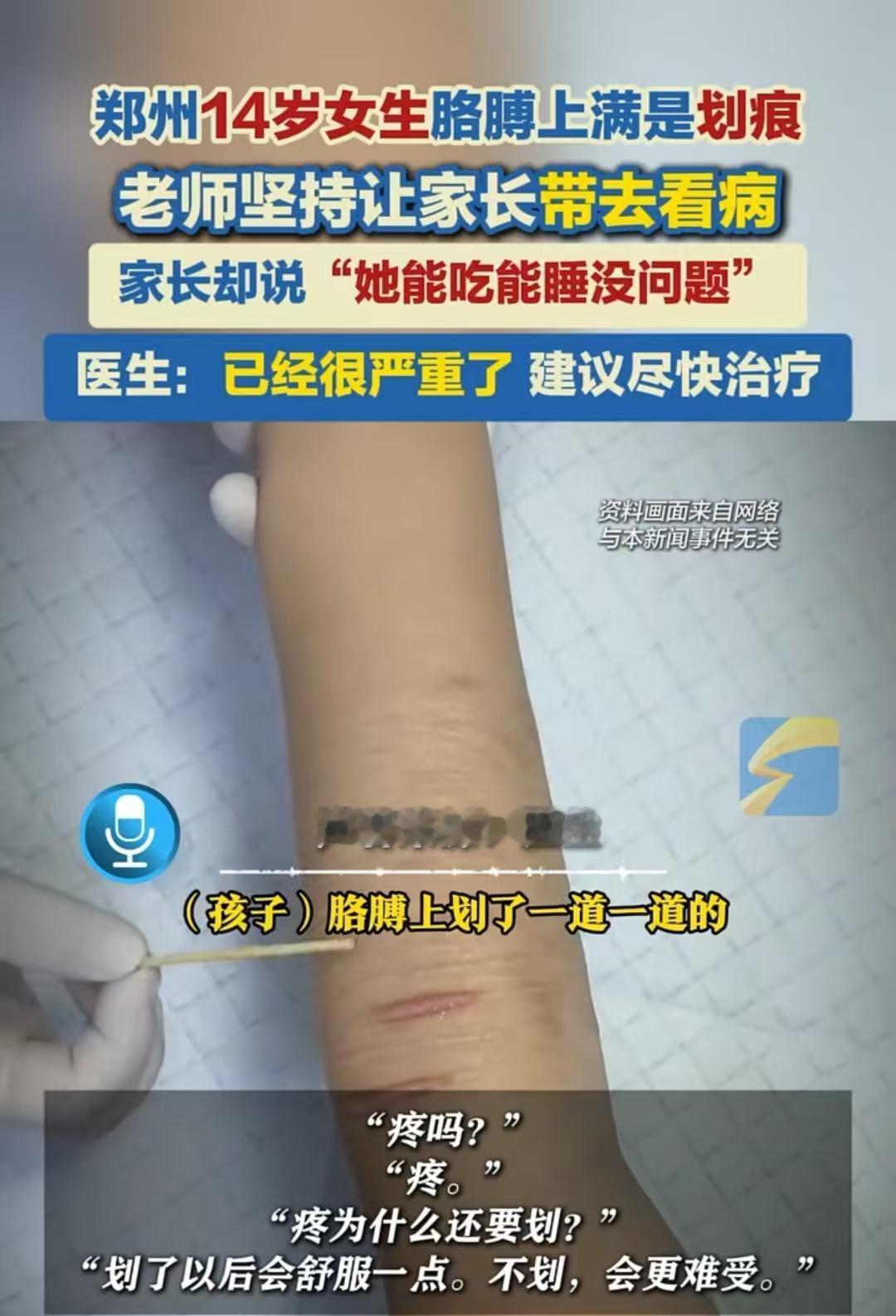 小女孩划伤自己自救，妈妈无视！河南一14岁的小女孩，手臂上有大量的划痕，老师发现