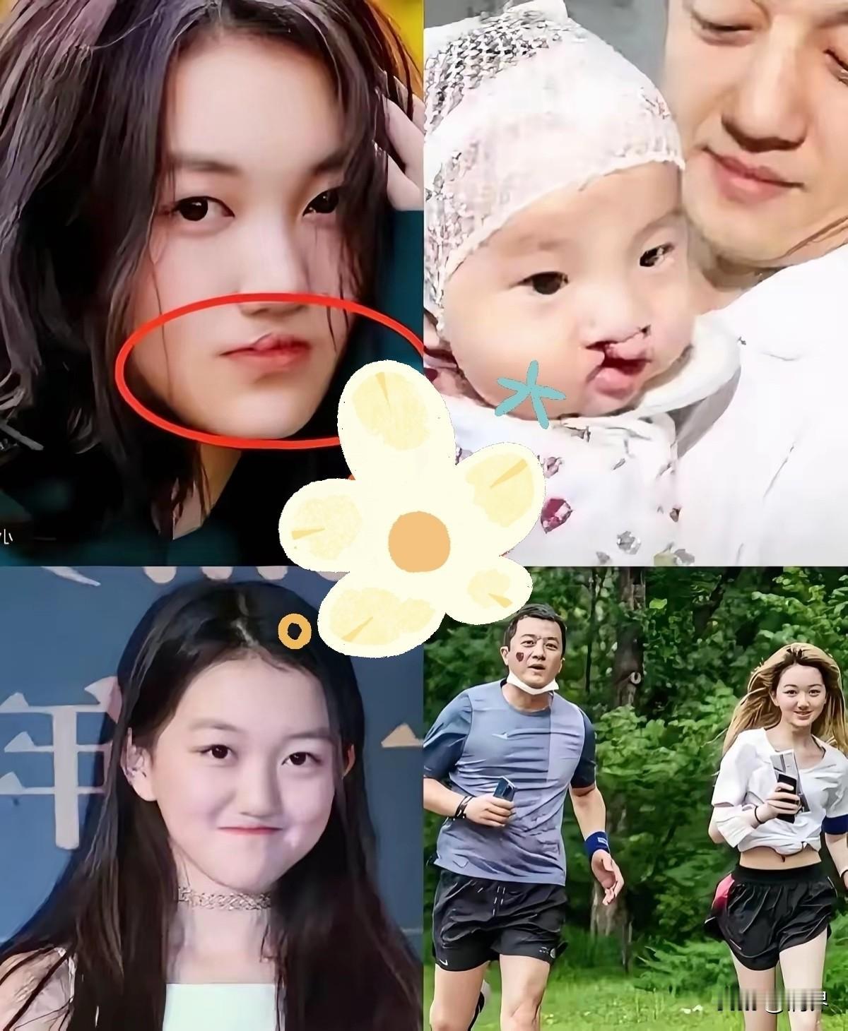 女儿出生时，医生那句“可能嫁不出去”的暗示，没有成为李亚鹏心里的枷锁。他做了一个