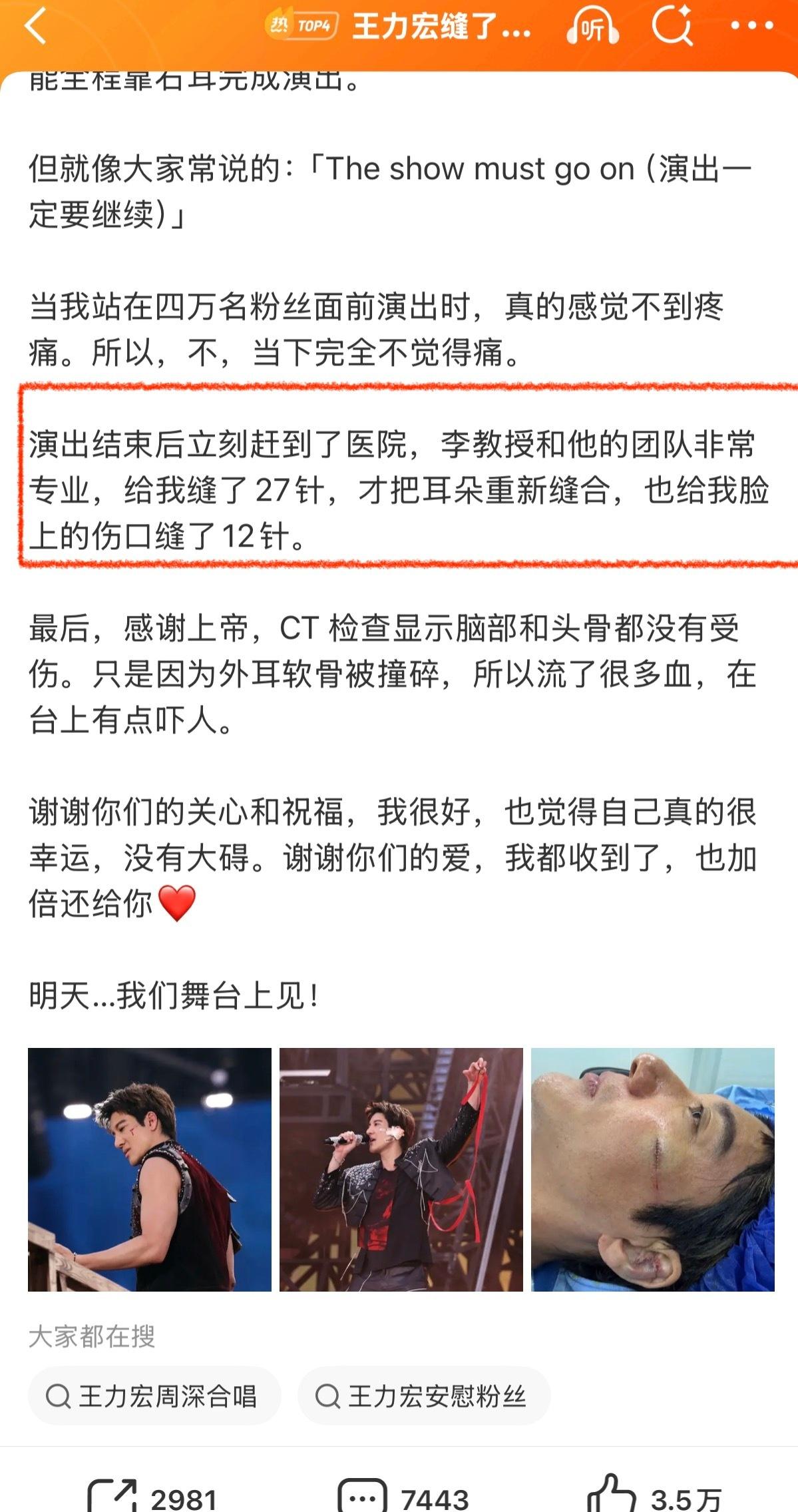 39针！！！摔倒后还在继续唱，演唱会结束才去的医院治疗，老一辈的艺术家，敬业精神