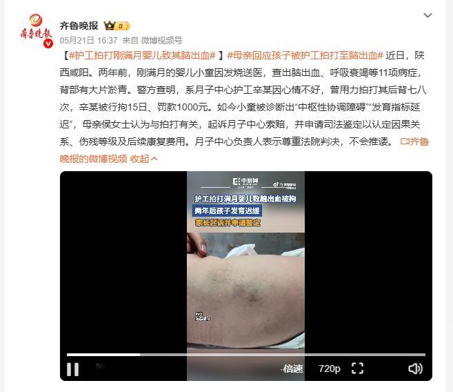 护工拍打刚满月婴儿致其脑出血 咸阳一名满月婴儿在月子中心遭护工拍打后背七八次，当