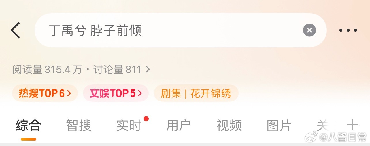 丁禹兮脖子前倾上rs了丁禹兮 脖子前倾
