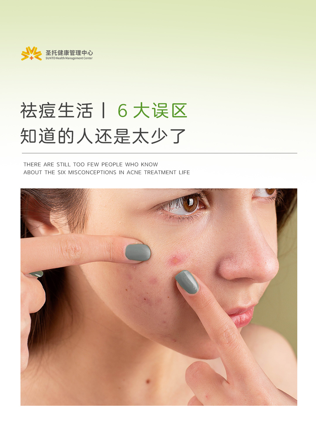 痘痘反复发作，多半和这些生活习惯有关