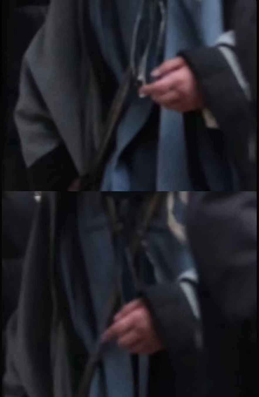 杨洋手肿状态 手还是肿的 