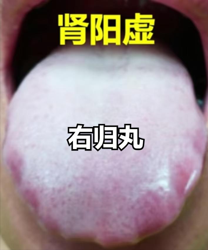 肾虚别乱补！5个中医秘方，对应5种肾虚，补对肾，重返18岁精气神！

1. 肾阳