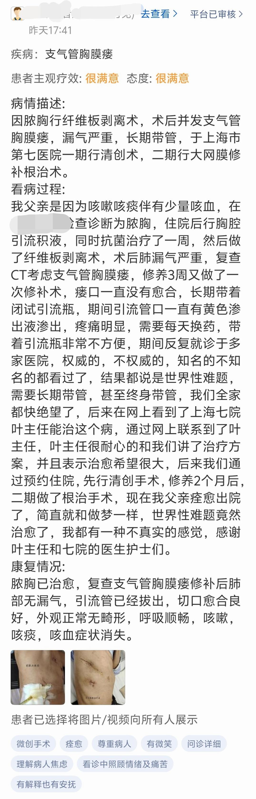 一位外科同行的父亲，支气管胸膜瘘病友，在上海七院，以最小创伤治愈，不负期望，也展现了我们独创疗法的强效、微创、自然、简洁。