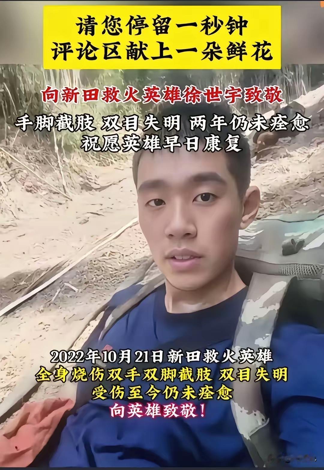 看哭了，一等功英雄徐世宇原来这么的高大帅气，为掩护战友，手脚，耳朵，眼睛都没了，