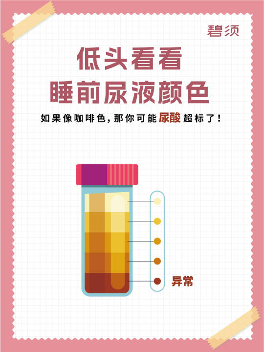 睡前尿液偏深？⁉️那要注意尿酸要高了！