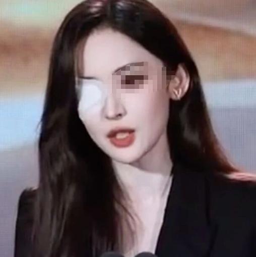 演员古力娜扎 ，回应病情，情况不太妙！
 最近古力娜扎首次聊起自己困扰许久的眼疾