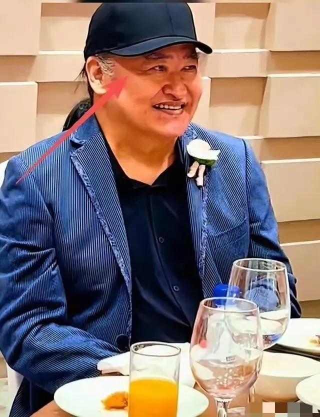 果然面相是会骗人的
刘欢就是个例子
去年10月女儿婚礼上，他还能吃能喝，面色红润