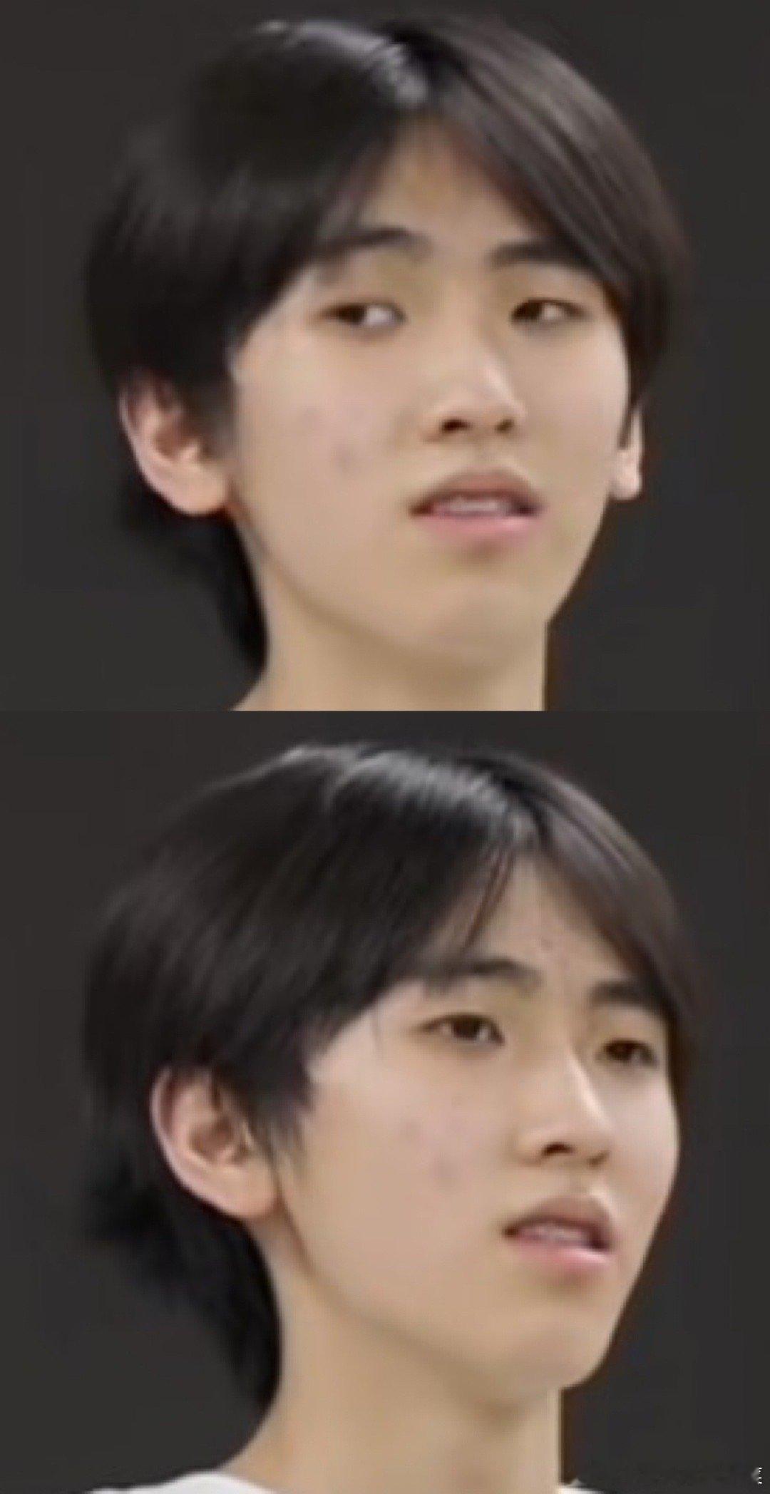 tg左奇函是不是爱长痘体质？ ​​​